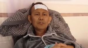 丈夫抽烟43年妻子确诊肺癌晚期
